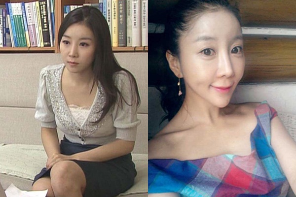 ต่างชาติวิจารณ์สาวเกาหลี เหลาหน้าวีทำลายความสวย ต่างชาติวิจารณ์สาวเกาหลี เหลาหน้าวีทำลายความสวย