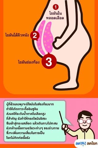 ภาวะไขมันในช่องท้อง ภาวะไขมันในช่องท้อง
