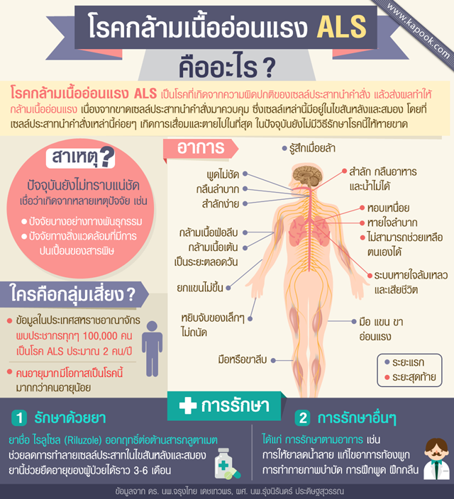 โรคกล้ามเนื้ออ่อนแรง เอแอลเอส โรคร้ายกาจที่รักษาหายขาดไม่ได้ โรคกล้ามเนื้ออ่อนแรง เอแอลเอส โรคร้ายกาจที่รักษาหายขาดไม่ได้