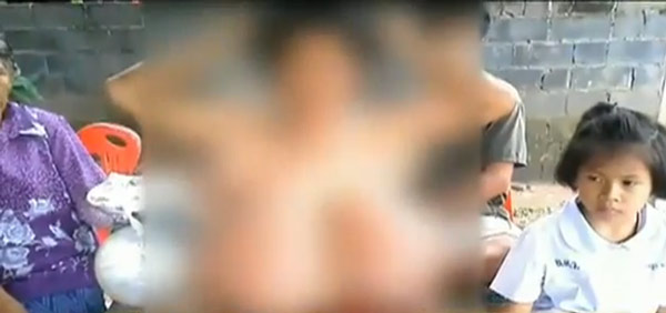 หญิงตั้งครรภ์หน้าอกโตผิดปกติ หญิงตั้งครรภ์หน้าอกโตผิดปกติ