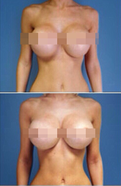 เอมมี่ อมลวรรณ เอมมี่ อมลวรรณ