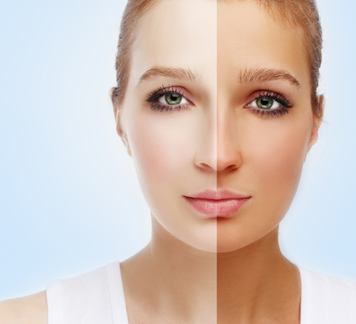 โดสเร่งผิวขาว