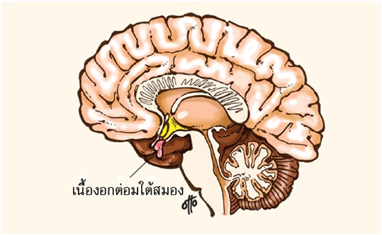 คุชชิ่ง ซินโดรม คุชชิ่ง ซินโดรม
