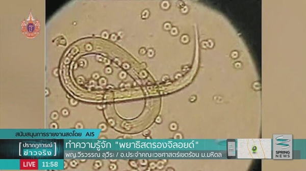 พยาธิสตรองจิลอยด์ พยาธิสตรองจิลอยด์