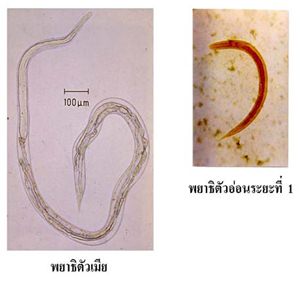 พยาธิเส้นด้าย
