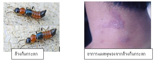 ด้วงก้นกระดก ด้วงก้นกระดก