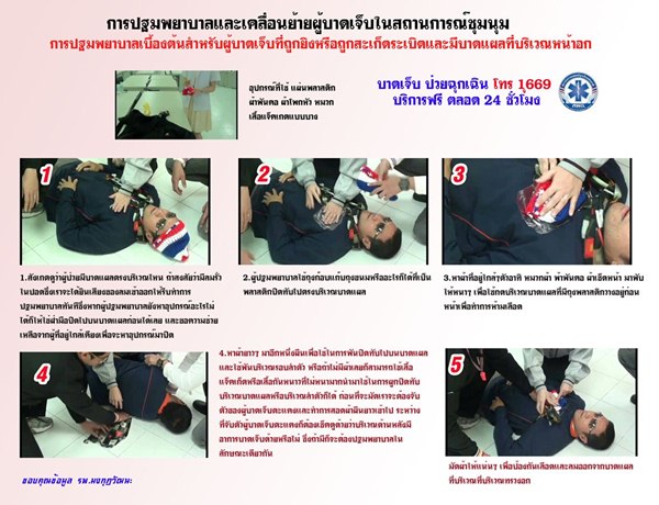 ปฐมพยาบาลเบื้องต้น ปฐมพยาบาลเบื้องต้น