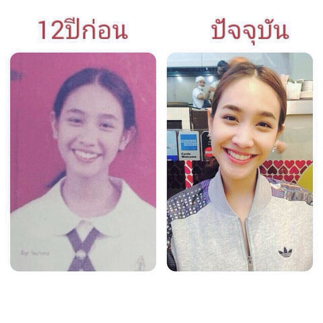 มิน พีชญา ศัลยกรรม มิน พีชญา ศัลยกรรม