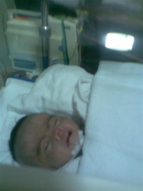 น้องโมเน่ต์ หนูน้อยแขนพิการ 2 ข้าง