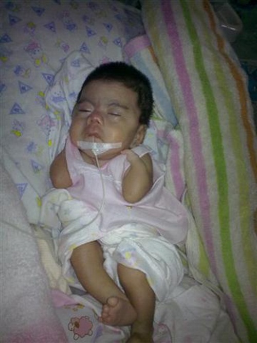 น้องโมเน่ต์ หนูน้อยแขนพิการ 2 ข้าง