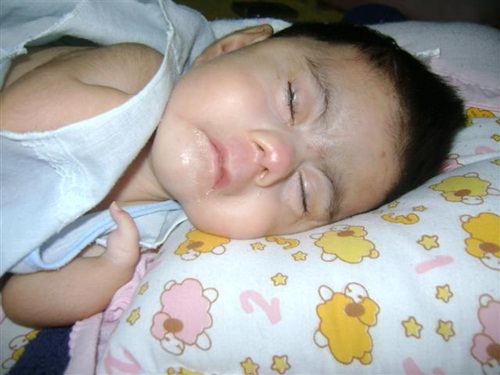 น้องโมเน่ต์ หนูน้อยแขนพิการ 2 ข้าง