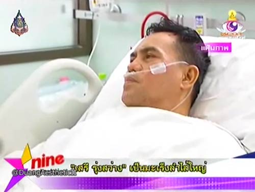 เสรี รุ่งสว่าง ป่วยเป็นมะเร็งลำไส้ใหญ่