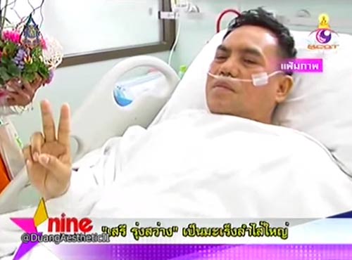 เสรี รุ่งสว่าง ป่วยเป็นมะเร็งลำไส้ใหญ่