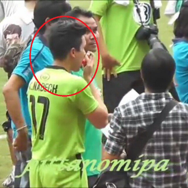 ณเดชน์ โรคหอบหืด ณเดชน์ โรคหอบหืด