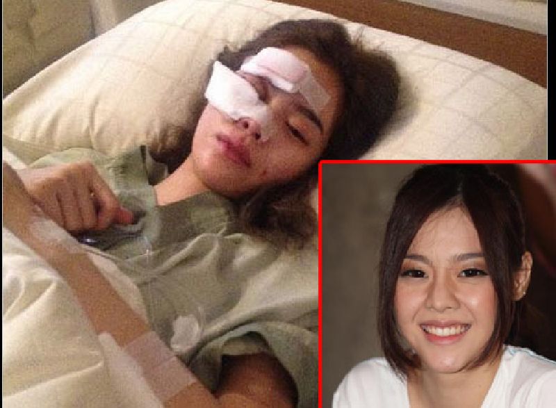 ไอซ์ ปรีชญา พงษ์ธนานิกร ประสบอุบัติเหตุรถชน ไอซ์ ปรีชญา พงษ์ธนานิกร ประสบอุบัติเหตุรถชน