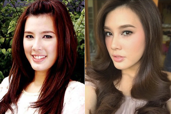 บี มาติกา บี มาติกา