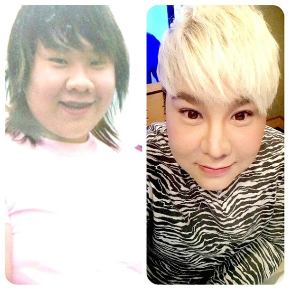 ดีเจบุ๊คโกะ ศัลยกรรม ดีเจบุ๊คโกะ ศัลยกรรม