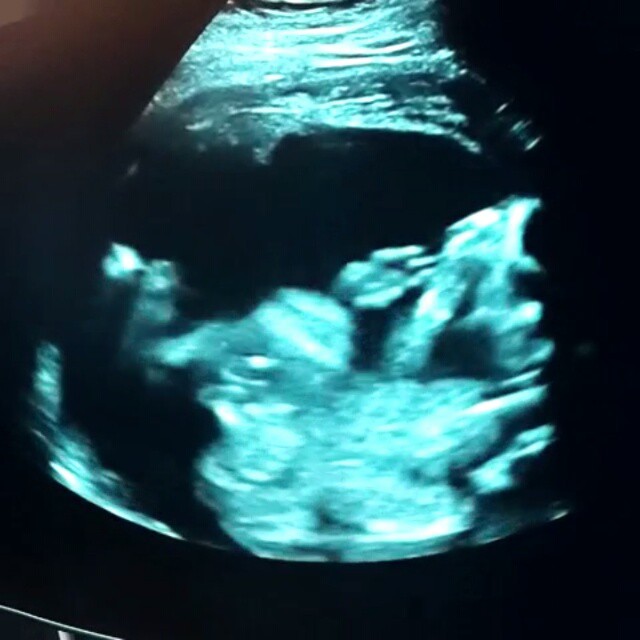 ปีเตอร์ พลอย เผยคลิปอัลตราซาวด์ลูกชายคนที่ 2 ปีเตอร์ พลอย เผยคลิปอัลตราซาวด์ลูกชายคนที่ 2