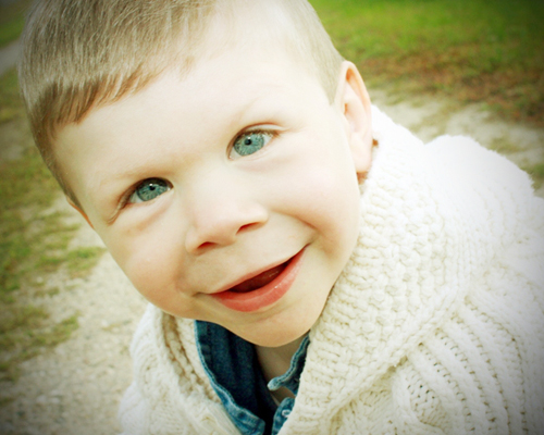 โรคนางฟ้า Williams Syndrome โรคนางฟ้า Williams Syndrome