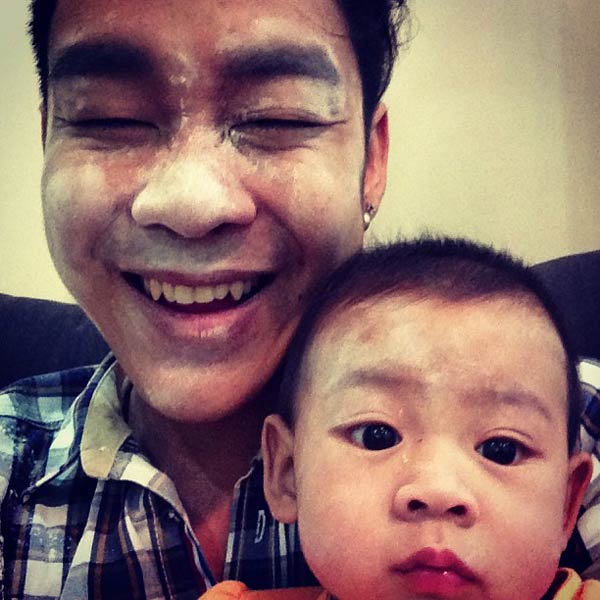 น้องยูจิน ลิ้นหัวใจรั่ว โจ๊ก โซคูล