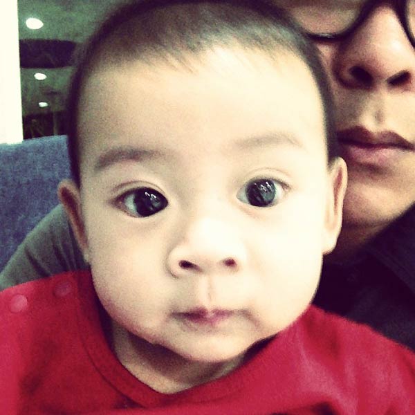 น้องยูจิน ลิ้นหัวใจรั่ว โจ๊ก โซคูล