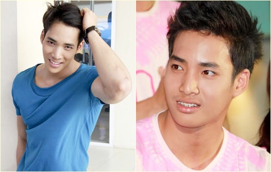 เด่นคุณ งามเนตร ศัลยกรรม เด่นคุณ งามเนตร ศัลยกรรม