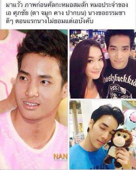 เด่นคุณ งามเนตร ศัลยกรรม เด่นคุณ งามเนตร ศัลยกรรม