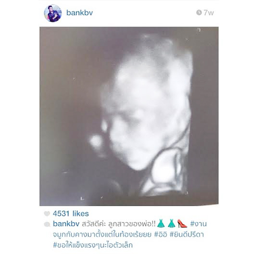 แบงค์ แบล็ควานิลลา เผยภาพอัลตราซาวด์ลูกสาว น้องนิลลา แบงค์ แบล็ควานิลลา เผยภาพอัลตราซาวด์ลูกสาว น้องนิลลา