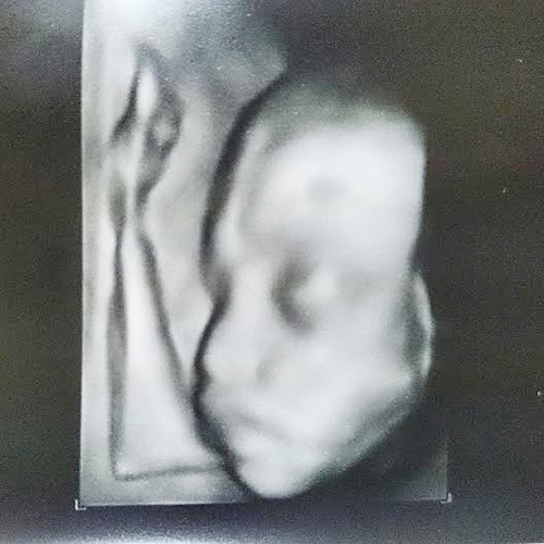 แบงค์ แบล็ควานิลลา เผยภาพอัลตราซาวด์ลูกสาว น้องนิลลา แบงค์ แบล็ควานิลลา เผยภาพอัลตราซาวด์ลูกสาว น้องนิลลา