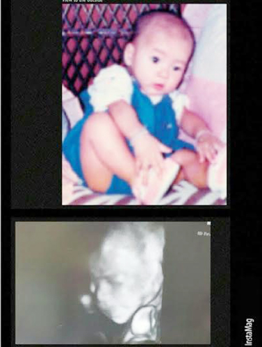 แบงค์ แบล็ควานิลลา เผยภาพอัลตราซาวด์ลูกสาว น้องนิลลา แบงค์ แบล็ควานิลลา เผยภาพอัลตราซาวด์ลูกสาว น้องนิลลา