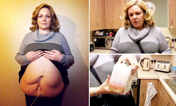 สาวอังกฤษไส้รั่ว สาวอังกฤษไส้รั่ว