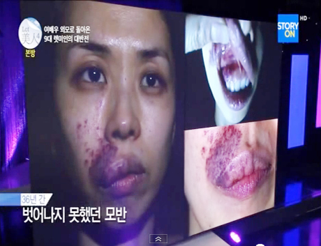 Let Me In ศัลยกรรม Let Me In ศัลยกรรม