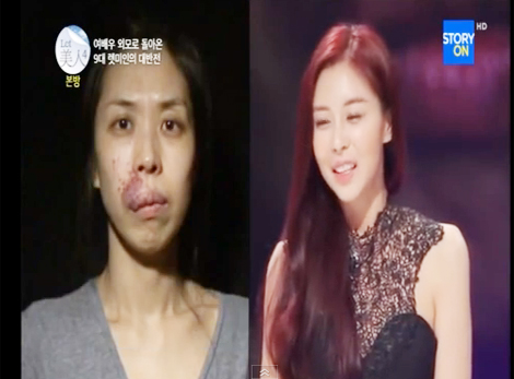 Let Me In ศัลยกรรม Let Me In ศัลยกรรม