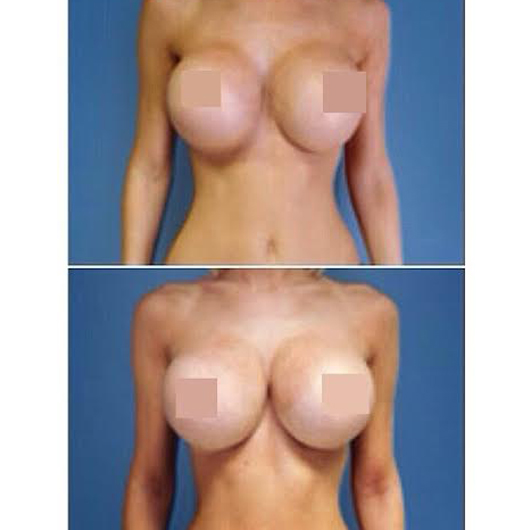 เอมมี่ อมลวรรณ เอาจริง อัพไซส์หน้าอกบิ๊กบึ้มกระชากใจ เอมมี่ อมลวรรณ เอาจริง อัพไซส์หน้าอกบิ๊กบึ้มกระชากใจ