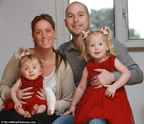 มหัศจรรย์! ทารกน้อยรอดชีวิตแม้กระดูกหัก 30 ท่อน ตั้งแต่อยู่ในครรภ์