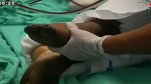 แมงมุมพิษกัดขาหนุ่มเมืองแพร่ อาจถึงขั้นตัดขาทิ้ง แมงมุมพิษกัดขาหนุ่มเมืองแพร่ อาจถึงขั้นตัดขาทิ้ง