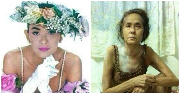 ภาพปัจจุบัน เพ็ญพร ไพฑูรย์ อดีตนางแบบดัง โรครุมเร้า ร่างกายผ่ายผอม ภาพปัจจุบัน เพ็ญพร ไพฑูรย์ อดีตนางแบบดัง โรครุมเร้า ร่างกายผ่ายผอม