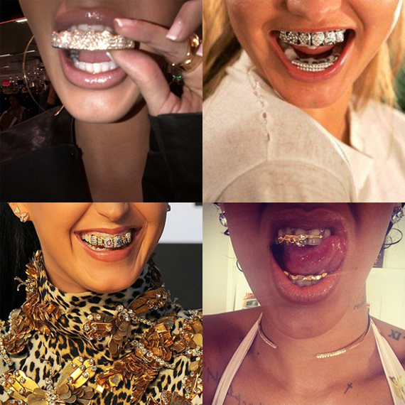 ฟันเลี่ยมเพชร ฟันเลี่ยมเพชร