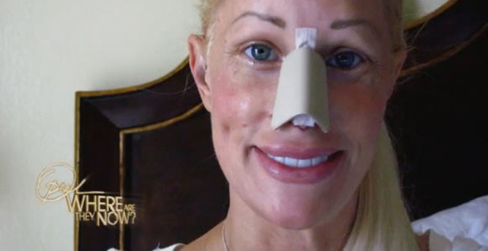 ศัลยกรรม ศัลยกรรม