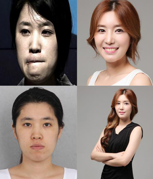 ศัลยกรรมเกาหลี ศัลยกรรมเกาหลี
