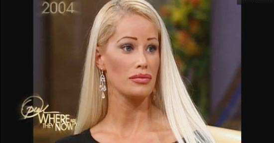 ศัลยกรรม ศัลยกรรม