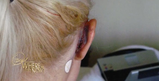 ศัลยกรรม ศัลยกรรม