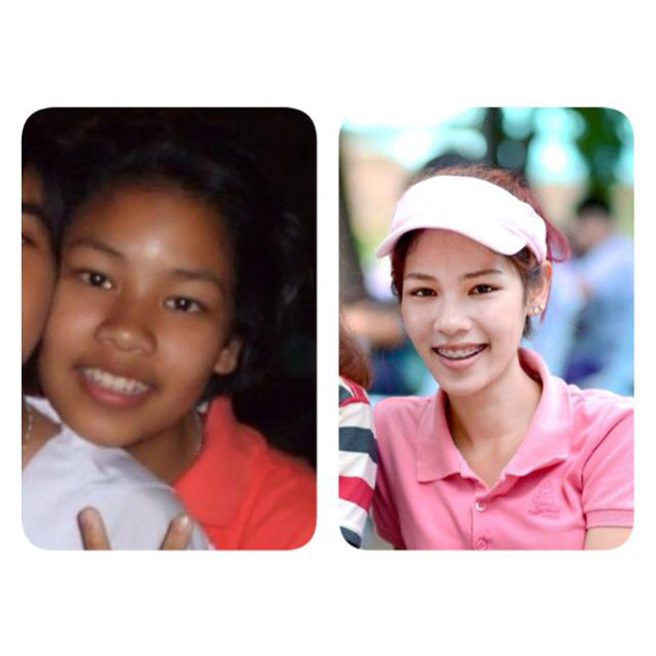 เคล็ดลับความสวย เคล็ดลับความสวย