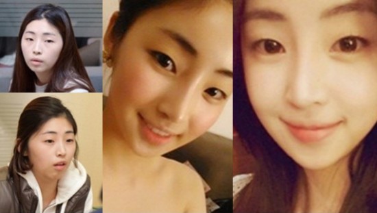 ศัลยกรรมเกาหลี ศัลยกรรมเกาหลี