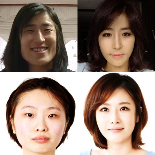 ศัลยกรรมเกาหลี ศัลยกรรมเกาหลี