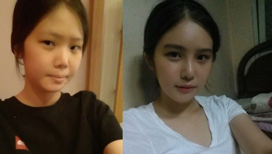 ศัลยกรรมเกาหลี ศัลยกรรมเกาหลี