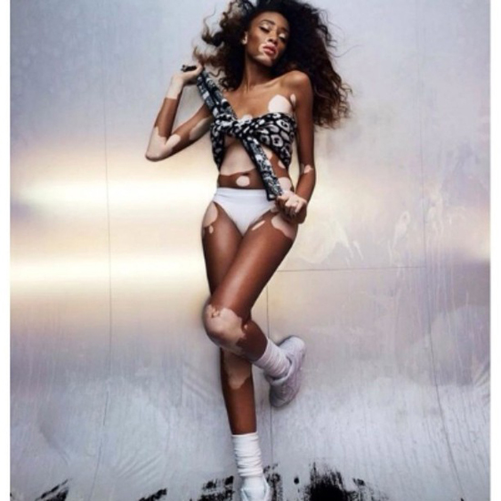 เสื้อผ้าแฟชั่น เสื้อผ้าแฟชั่น