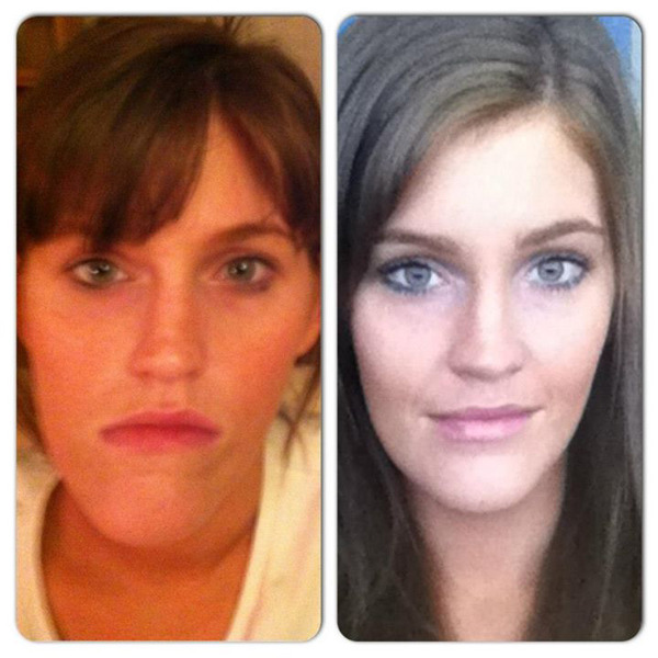 ศัลยกรรมกราม ศัลยกรรมกราม