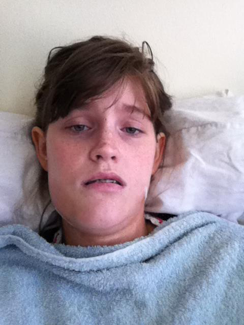 ศัลยกรรมกราม ศัลยกรรมกราม