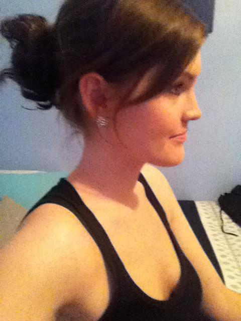 ศัลยกรรมกราม ศัลยกรรมกราม